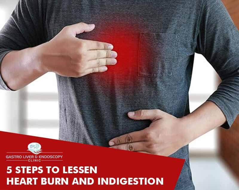 5 Steps To Lessen Heartburn And Indigestion