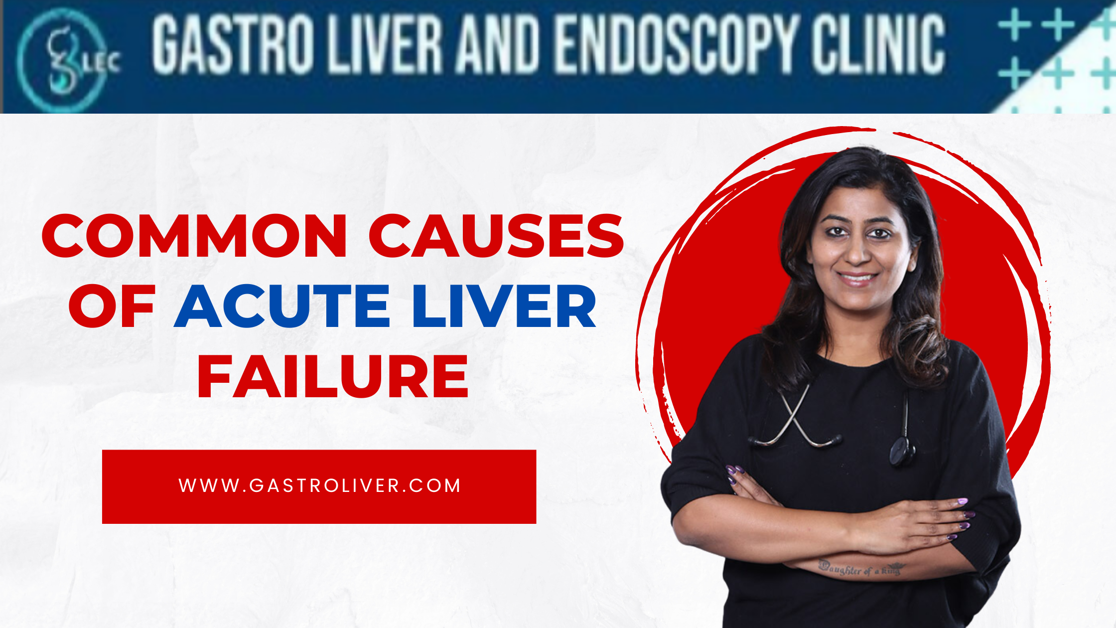 Common Causes of Acute Liver Failure